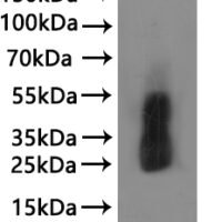 Recombinant Macaca fascicularis Tetraspanin (TSPAN8)-VLPs Protein - BioCrest Sci