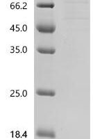 Recombinant Human Transient receptor potential cation channel subfamily V member 2 (TRPV2)-Detergent Protein - BioCrest Sci