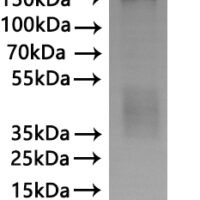 Recombinant Macaca fascicularis Leucine rich repeat containing G protein-coupled receptor 5 (LGR5)-VLPs Protein - BioCrest Sci