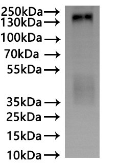Recombinant Macaca fascicularis Leucine rich repeat containing G protein-coupled receptor 5 (LGR5)-VLPs Protein, Macaca fascicularis (Crab-eating macaque) (Cynomolgus monkey), Mammalian cell, C-terminal 10xHis-tagged, 99.2kDa, purity >The purity information is not available for VLPs proteins.