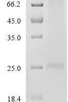 Recombinant Acinetobacter baumannii Translocator protein, LysE family Protein - BioCrest Sci