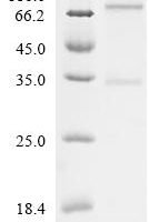 Recombinant Human Aquaporin-4(AQP4) Protein - BioCrest Sci