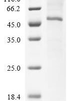 (Tris-Glycine gel) Discontinuous SDS-PAGE (reduced) with 5% enrichment gel and 15% separation gel.