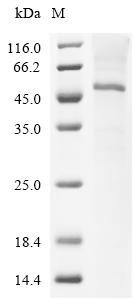 Recombinant Human Cystine/glutamate transporter (SLC7A11)(K472Q,K473Q,R475Q,R478Q,K483Q,R486Q) Protein, Homo sapiens (Human), in vitro E.coli expression system, N-terminal 10xHis-tagged, 56.8kDa, purity >85% as determined by SDS-PAGE.