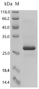 Recombinant Human Protein Mpv17 (MPV17) Protein, Homo sapiens (Human), E.coli, C-terminal 6xHis-tagged, 25.7kDa, purity >95% as determined by SDS-PAGE.