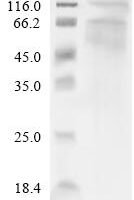 (Tris-Glycine gel) Discontinuous SDS-PAGE (reduced) with 5% enrichment gel and 15% separation gel.