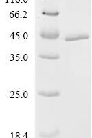 (Tris-Glycine gel) Discontinuous SDS-PAGE (reduced) with 5% enrichment gel and 15% separation gel.