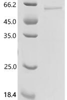 (Tris-Glycine gel) Discontinuous SDS-PAGE (reduced) with 5% enrichment gel and 15% separation gel.