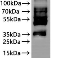 CSB-MP005678MO is detected by Mouse anti-6*His monoclonal antibody