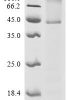 (Tris-Glycine gel) Discontinuous SDS-PAGE (reduced) with 5% enrichment gel and 15% separation gel.