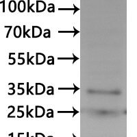CSB-MP7352HU is detected by Mouse anti-6*His monoclonal antibody