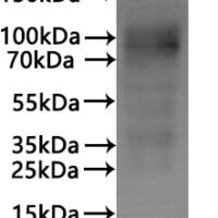 CSB-MP006255HUd7 is detected by Mouse anti-6*His monoclonal antibody