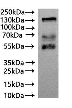 Recombinant Human BDNF/NT-3 growth factors receptor (NTRK2)-VLPs Protein, Homo sapiens (Human), Mammalian cell, C-terminal 10xHis-tagged, 89.7kDa, purity >VLPs