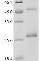 Recombinant Staphylococcus aureus Histidine kinase (agrC), Nanodisc Protein - BioCrest Sci