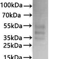 Recombinant Human C-C chemokine receptor type 3 (CCR3)-VLPs Protein - BioCrest Sci