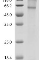 Recombinant Mouse NADPH oxidase 4 (Nox4) Protein - BioCrest Sci