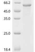 Recombinant Human Metalloendopeptidase OMA1, mitochondrial (OMA1) Protein - BioCrest Sci