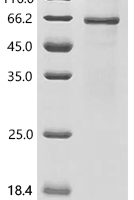 Recombinant Human Disintegrin and metalloproteinase domain-containing protein 23 (ADAM23) Protein - BioCrest Sci