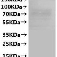 Recombinant Mouse Apelin receptor (Aplnr)-VLPs Protein - BioCrest Sci