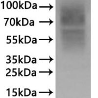 Recombinant Human C-C chemokine receptor type 7 (CCR7)-VLPs Protein - BioCrest Sci