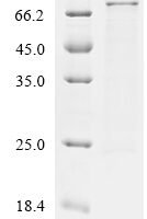 Recombinant Gibberella zeae Chromosome 4, complete genome Protein - BioCrest Sci