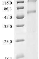 Recombinant Human Protein spinster homolog 1 (SPNS1) Protein - BioCrest Sci
