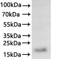 Recombinant Human Claudin-7 (CLDN7)-VLPs Protein - BioCrest Sci