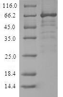 Recombinant Nipah virus Glycoprotein G (G) Protein - BioCrest Sci
