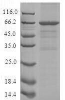 Recombinant Human Schlafen family member 12-like (SLFN12L) Protein - BioCrest Sci
