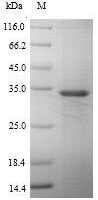 Recombinant Human Arachidonate 5-lipoxygenase-activating protein (ALOX5AP) Protein - BioCrest Sci