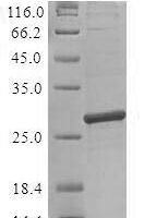 Recombinant Lactococcus lactis subsp. lactis Prolipoprotein diacylglyceryl transferase (lgt) Protein - BioCrest Sci