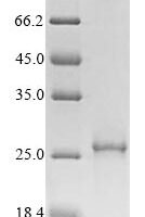 Recombinant Human Myelin proteolipid protein (PLP1) Protein - BioCrest Sci