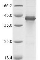 Recombinant Human Stearoyl-CoA desaturase (SCD) Protein - BioCrest Sci