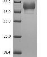 Recombinant Human 5-hydroxytryptamine receptor 3E (HTR3E), partial Protein - BioCrest Sci