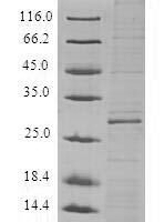 (Tris-Glycine gel) Discontinuous SDS-PAGE (reduced) with 5% enrichment gel and 15% separation gel.