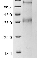 (Tris-Glycine gel) Discontinuous SDS-PAGE (reduced) with 5% enrichment gel and 15% separation gel.