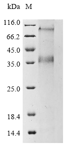 Recombinant Human Proton-coupled zinc antiporter SLC30A8 (SLC30A8) Protein, Homo sapiens (Human), in vitro E.coli expression system, N-terminal 10xHis-tagged, 43.6kDa, purity >85% as determined by SDS-PAGE.
