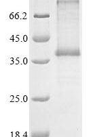 (Tris-Glycine gel) Discontinuous SDS-PAGE (reduced) with 5% enrichment gel and 15% separation gel.