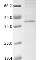 (Tris-Glycine gel) Discontinuous SDS-PAGE (reduced) with 5% enrichment gel and 15% separation gel.