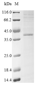 Recombinant Human P2Y purinoceptor 12 (P2RY12) Protein, Homo sapiens (Human), in vitro E.coli expression system, N-terminal 10xHis-tagged, 42.2kDa, purity >85% as determined by SDS-PAGE.