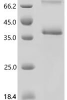 (Tris-Glycine gel) Discontinuous SDS-PAGE (reduced) with 5% enrichment gel and 15% separation gel.