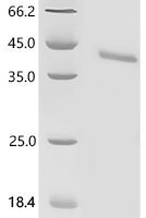 (Tris-Glycine gel) Discontinuous SDS-PAGE (reduced) with 5% enrichment gel and 15% separation gel.