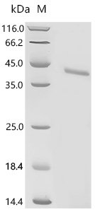 Recombinant Human Vasopressin V2 receptor (AVPR2) Protein, in vitro E.coli expression system, N-terminal 10xHis-tagged and C-terminal Twin-Strep-tagged, 44.8kDa, purity >85% as determined by SDS-PAGE.