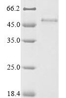 Recombinant Human Transmembrane protein PVRIG (PVRIG) Protein - BioCrest Sci