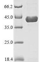 Recombinant Mouse Dihydroorotate dehydrogenase (quinone), mitochondrial (Dhodh) Protein - BioCrest Sci
