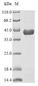 Recombinant Mouse Dihydroorotate dehydrogenase (quinone), mitochondrial (Dhodh) Protein, Mus musculus (Mouse), in vitro E.coli expression system, C-terminal 6xHis-tagged, 44.2kDa, purity >85% as determined by SDS-PAGE.