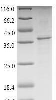 Recombinant Pig Translocator protein (TSPO) Protein - BioCrest Sci