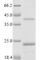 Recombinant Rat Peripheral myelin protein 22 (Pmp22) Protein - BioCrest Sci