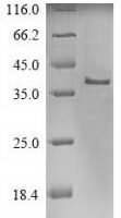Recombinant Human p53 apoptosis effector related to PMP-22 (PERP) Protein - BioCrest Sci