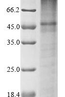 Recombinant Human Potassium channel subfamily K member 3 (KCNK3) Protein - BioCrest Sci